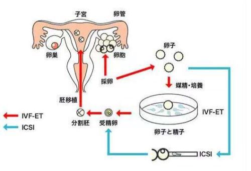 试管代孕